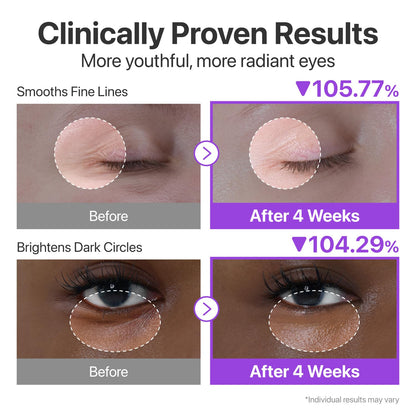 Numbuzin No.9 NAD+ Retinol Volumetox Eye Cream – 10ml