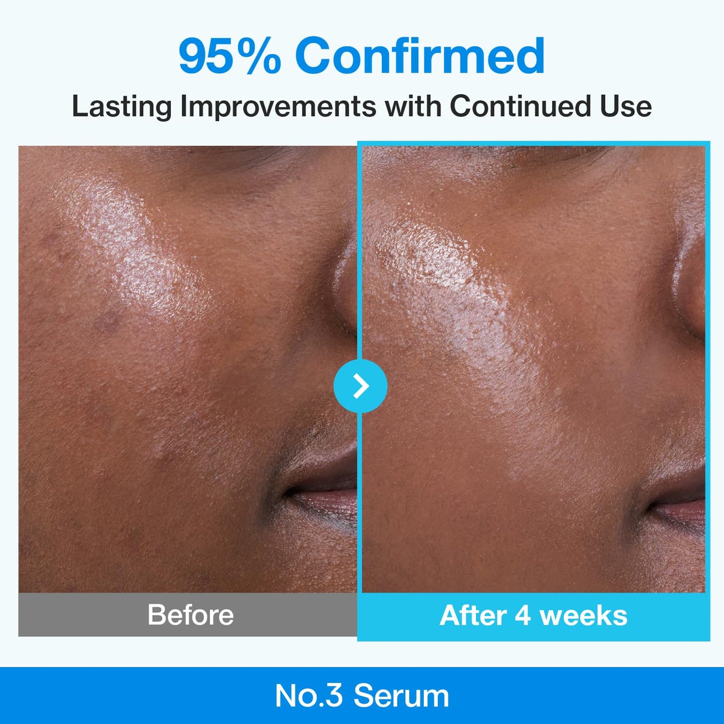numbuzin No.3 Blue Bio-Retinol Pore Refining Serum – 50ml
