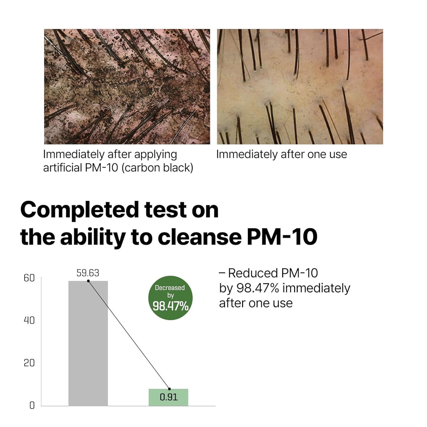 SOME BY MI Cica Peptide Anti Hair Loss Derma Scalp Shampoo – 285ml / 9.63 fl oz