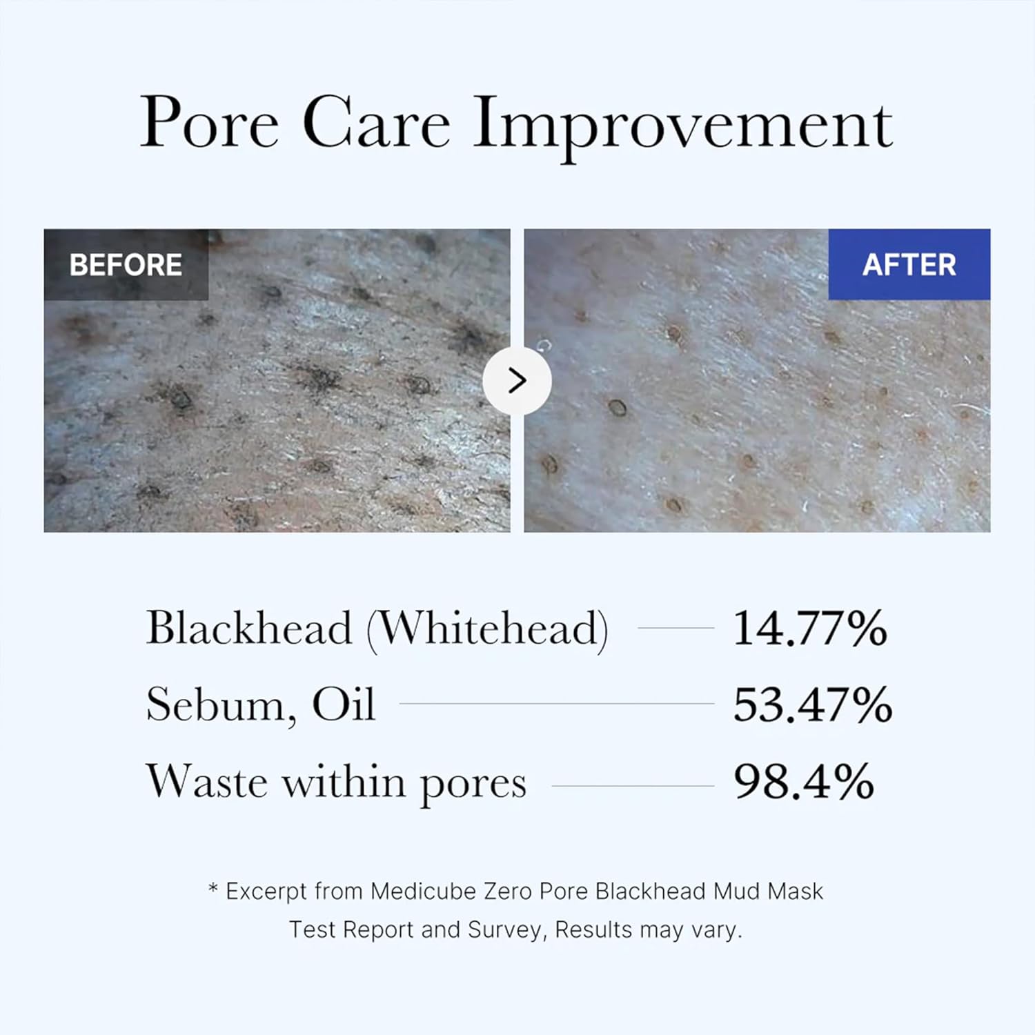 medicube Zero Pore Blackhead Mud Mask – 100g