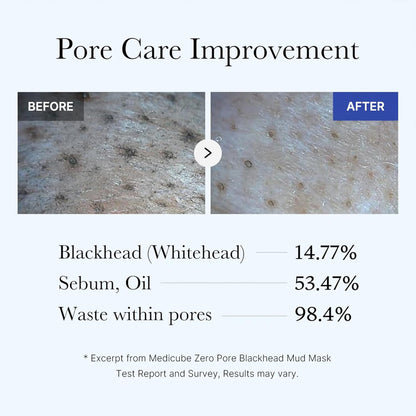 medicube Zero Pore Blackhead Mud Mask – 100g