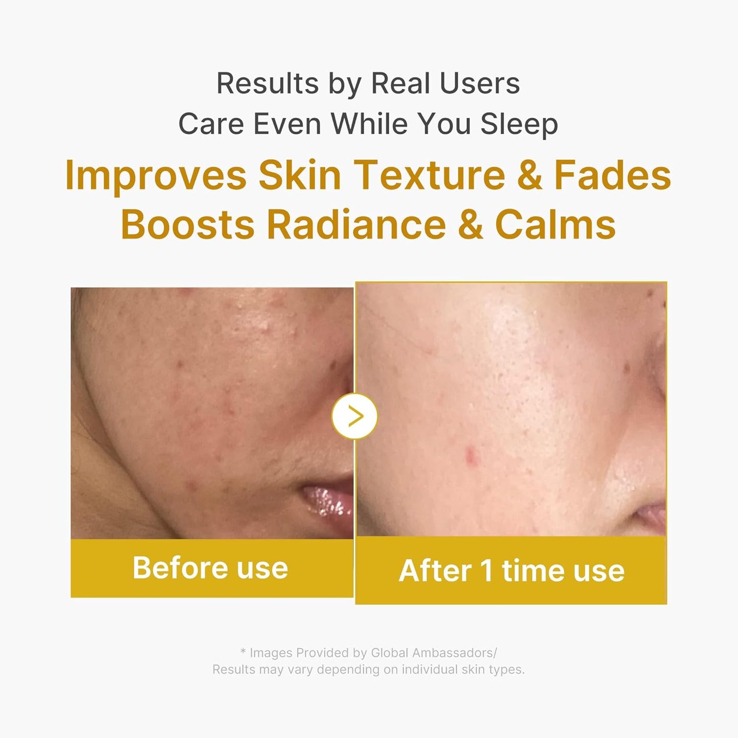Medicube Kojic Acid Turmeric Vitamin C Wrapping Mask – Overnight Peel-Off Mask