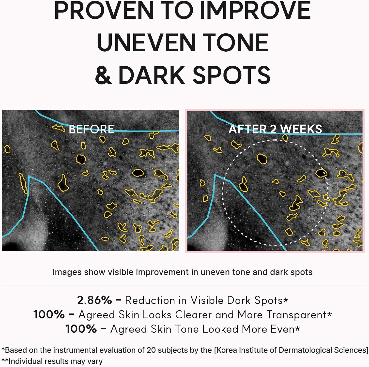 Arencia TXA Booster Shot | Intensive Dark Spot Correcting Serum 30ml