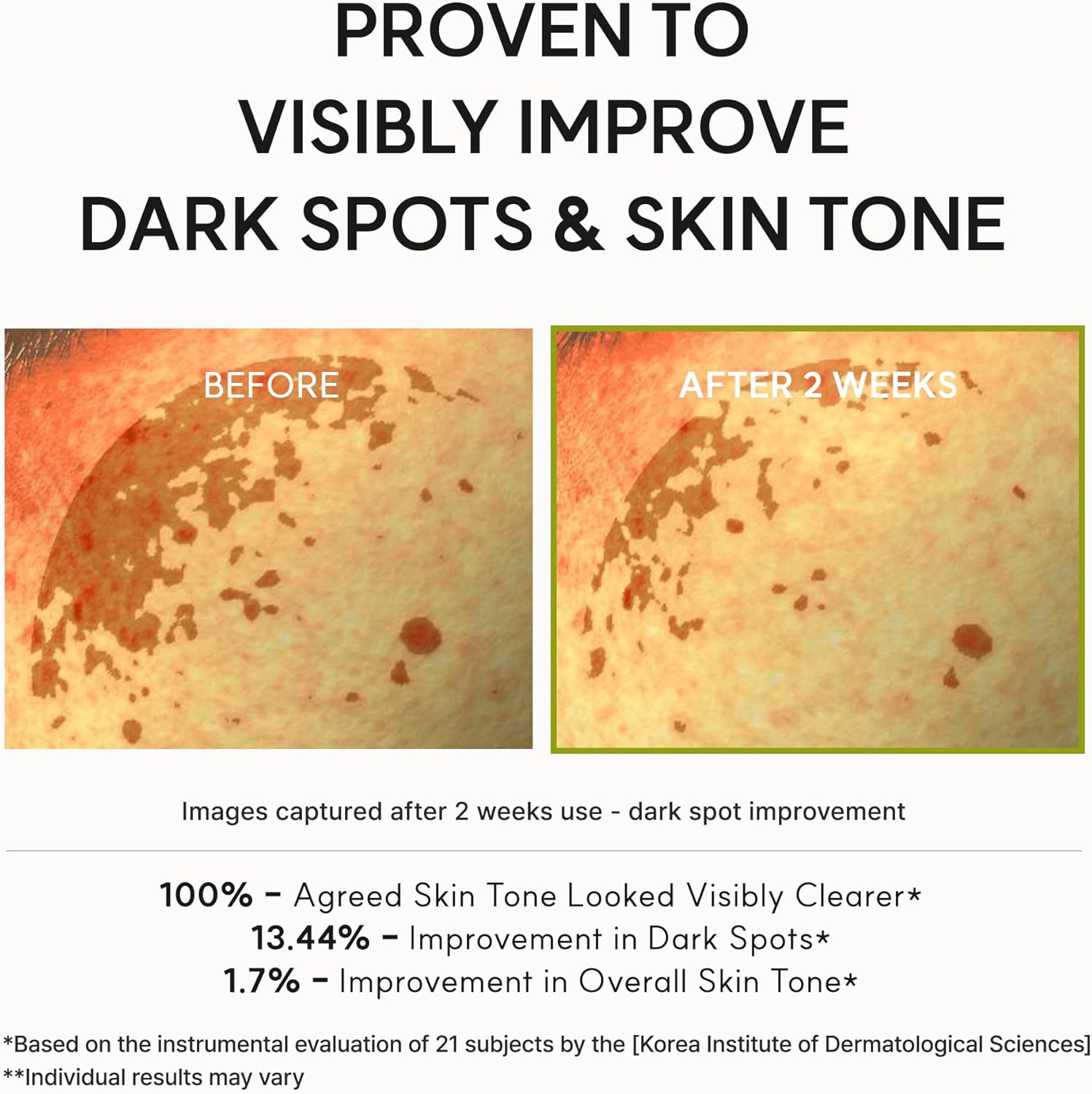 Before and after comparison of dark spots on skin with text indicating improvement.