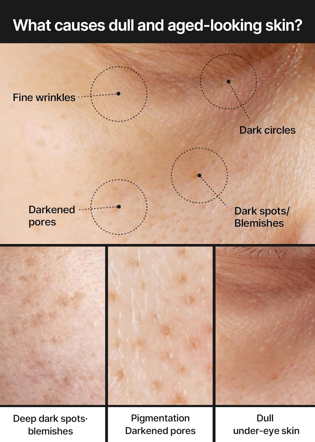 Diagram of skin conditions including fine wrinkles, dark circles, dark spots, darkened pores, deep dark spots, pigmentation, and dull under-eye skin.